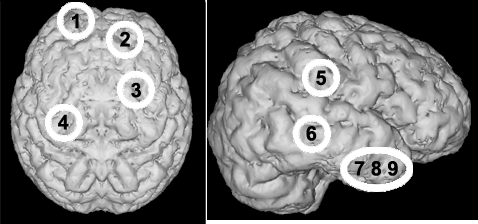 Exact location of nine cortical samples obtained by biopsy and used for postsynaptic density isolation.